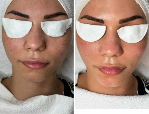 أفضل طرق تنظيف البشرة بعمق للحفاظ على نضارتها وحمايتها من الشوائب اليومية