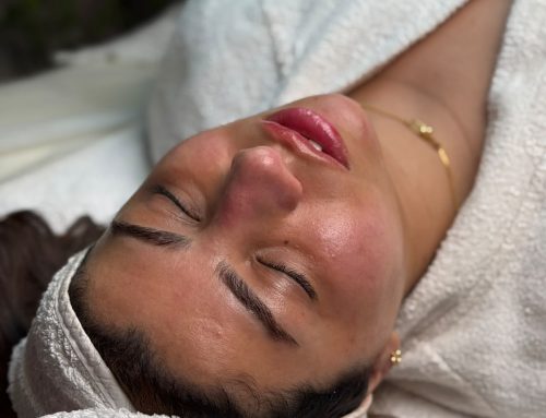 أسعار إزالة الشعر بالليزر فى اسطنبول:تحديث لأخر الأسعار