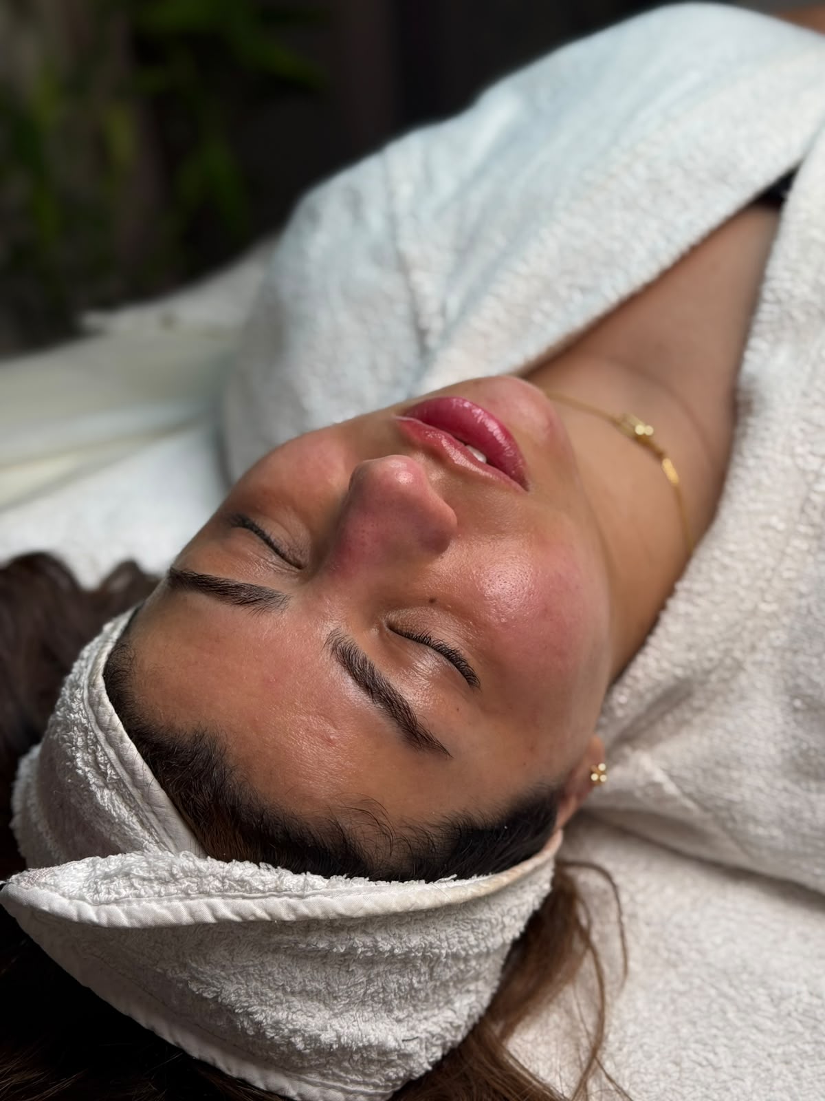 laser hair removal Marwa Al-Khatib Salon: The Best Beauty Salon in Istanbul